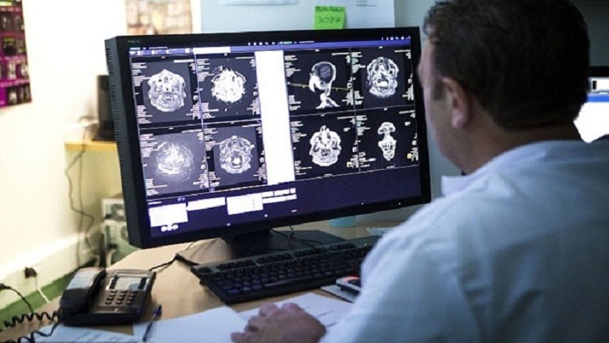 دراسة: التوتر العصبي يؤدي إلى أمراض القلب والسكتة الدماغية