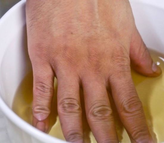 وضع يديه فى الماء والخل 3 مرات في اليوم.. والنتيجة مذهلة!