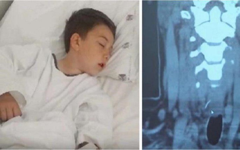 اشتكى من الم رهيب في بطنه بعد تناول الـ"همبرغر"... ثم كانت الصدمة!