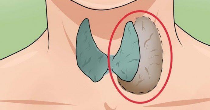 علامات خمول الغدة الدرقية وطرق علاجها