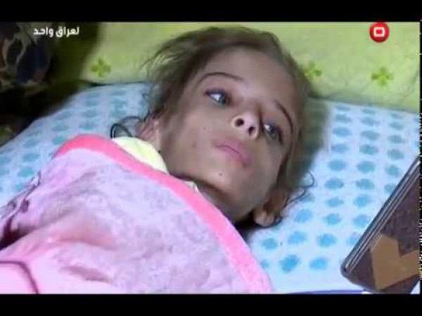 صورة.. عراقية تعذب ابنتها بطريقة مأساوية!! 