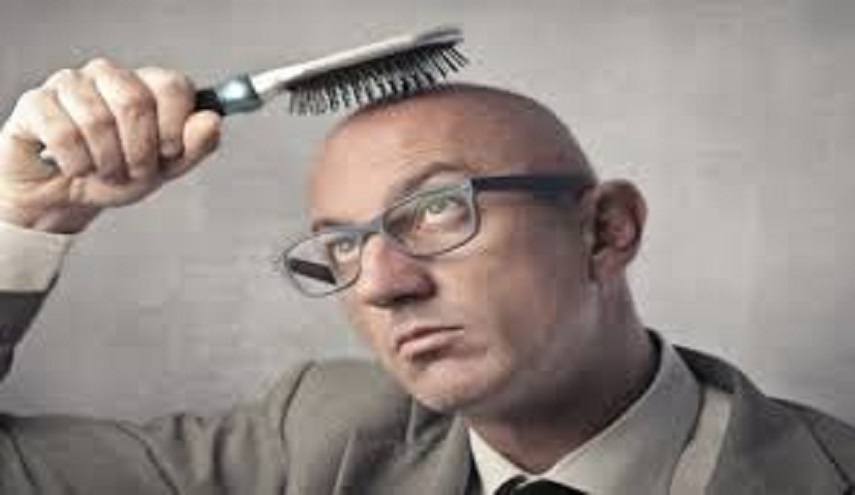 ابتكار مستحضر جديد يقضي على الصلع