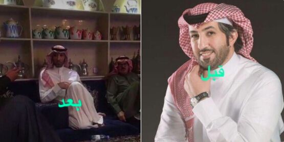 كأنه شخص ثاني..”شاهد” صورة صادمة للشاعر السعودي زياد بن نحيت عقب الإفراج عنه!
