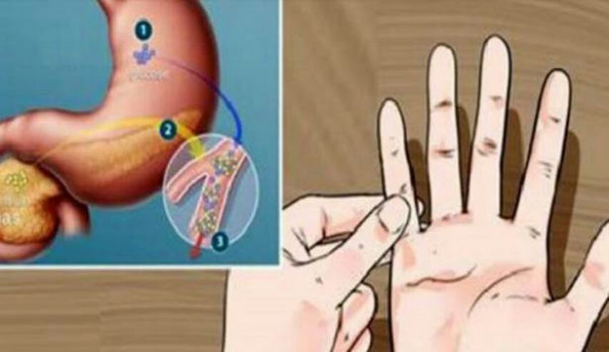 هل أنت معرض للإصابة بالسكري ؟ اكتشف هذا في دقيقة واحدة بفضل هذا الاختبار