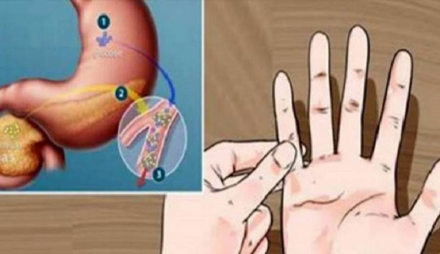  هل أنت معرض للإصابة بالسكري؟ اكتشف الأن