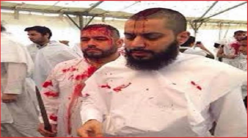 الى من يؤيد التطبير... مبرراتكم واهية!!!