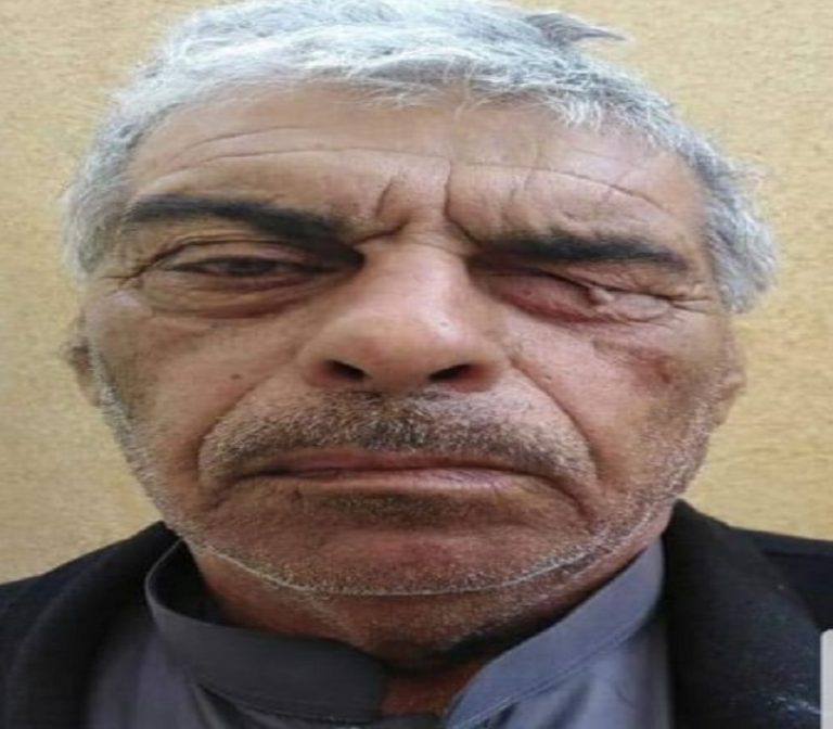 اعتقال اعور البغدادي الدجال بالانبار