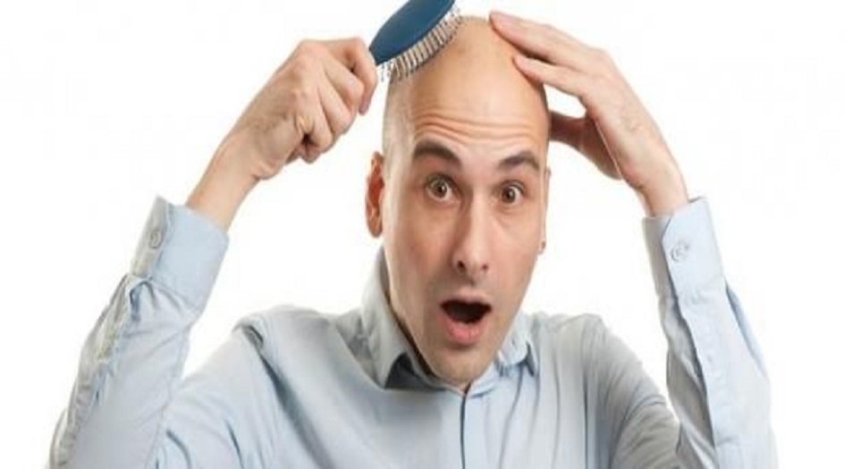 الصلع.. ماذا فعل المصريون القدماء؟ وما حقيقة المرض؟