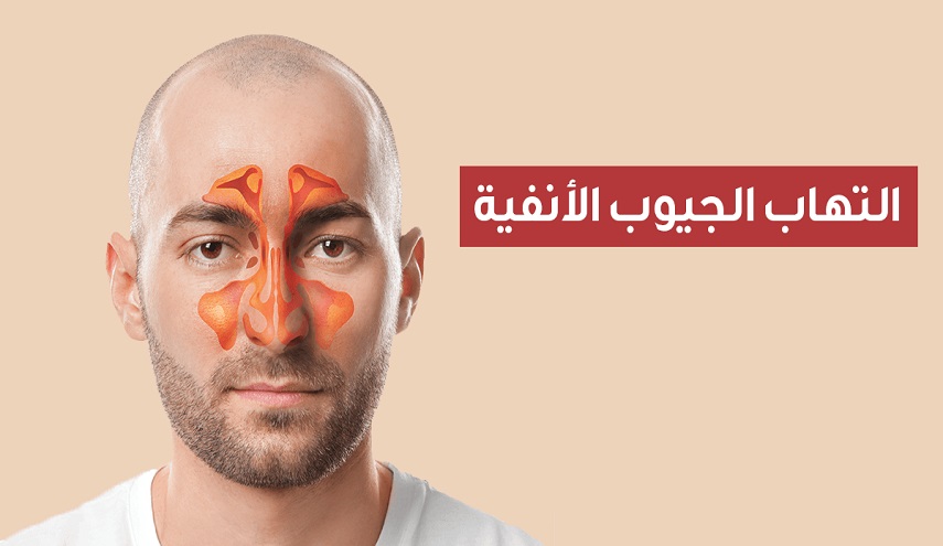 انتباه.. 10 أعراض تنذرك بالإصابة بـالجيوب الأنفية