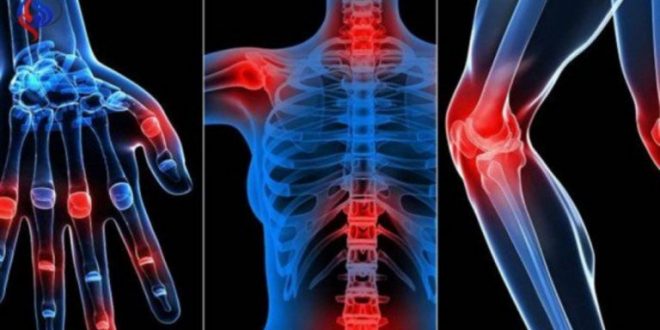بينها القهوة وعصير الطماطم.. 7مشروبات تسبب آلام المفاصل عليك تجنبها