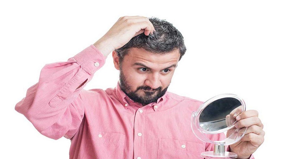 علاجات منزلية تخلصك من الشعر الأبيض