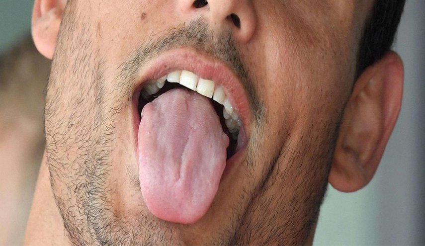 متى يكشف لسانك اصابتك بامراض القلب؟