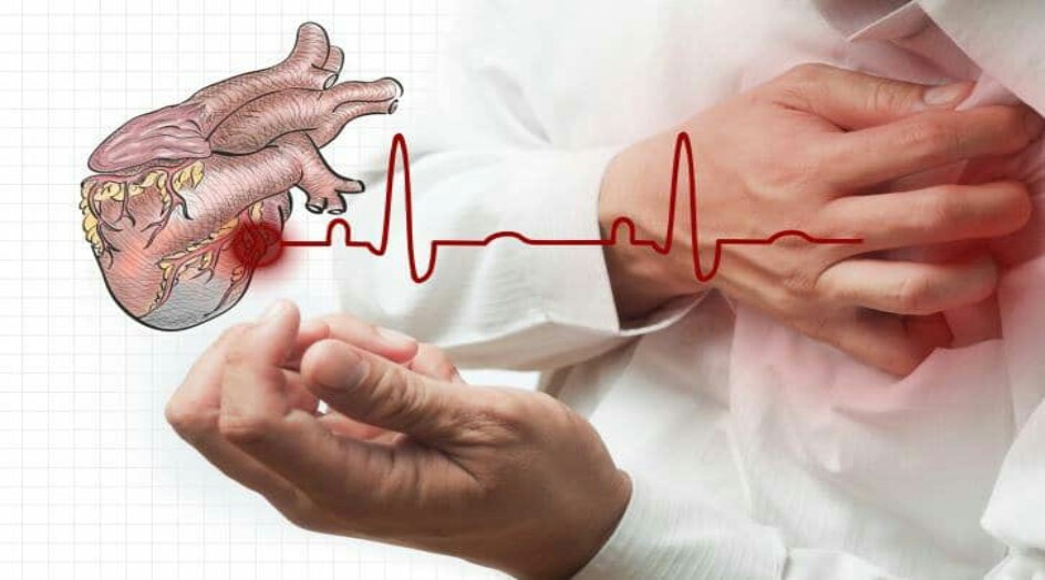 تعرف على علامة لاحتشاء عضلة القلب التي يجهلها الكثير