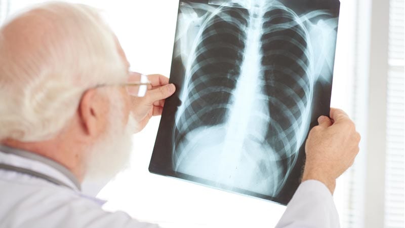 أمراض تقتل الإنسان إذا اجتمعت مع كورونا
