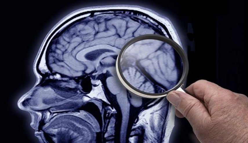 دراسة خطيرة تكشف تأثير كورونا على المخ والذاكرة