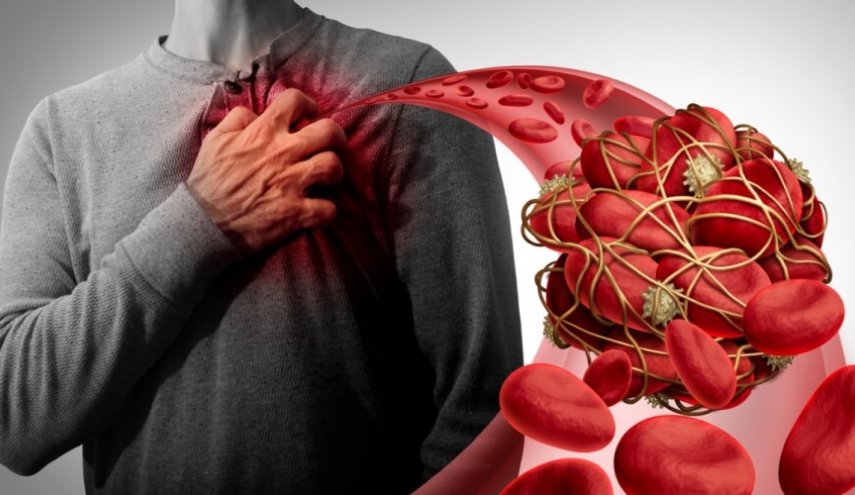 باحثون يحذرون من مخاطر تجلط الدم حتى بعد شهور من الإصابة بكورونا