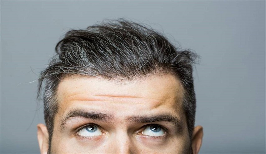 الشيب المبكر ... أسباب ونصائح لتأخير ظهوره