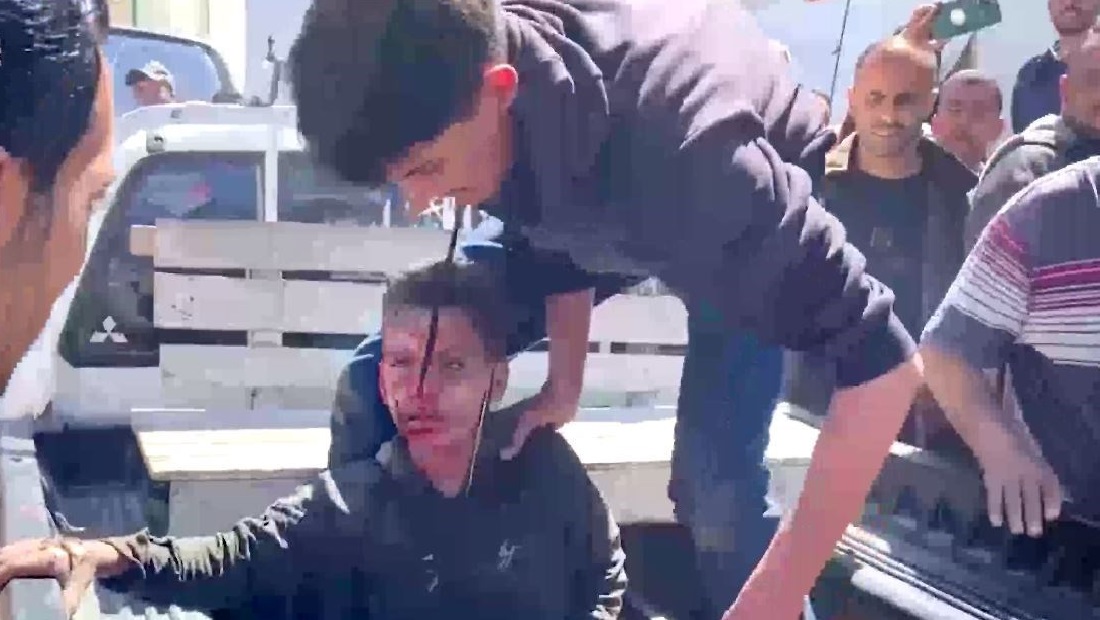 مائتا طفل استشهدوا فقط خلال أول يومين من عودة العدوان على غزة 