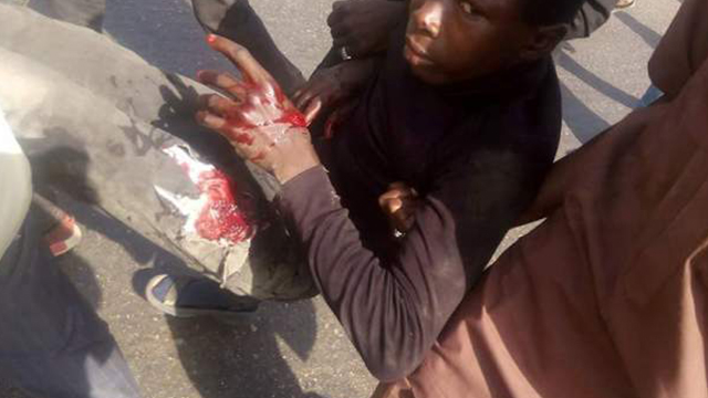 شهداء وجرحى في هجوم للشرطة النيجيرية على موكب عزاء بمناسبة ذكرى أربعين الإمام الحسين عليه السلام