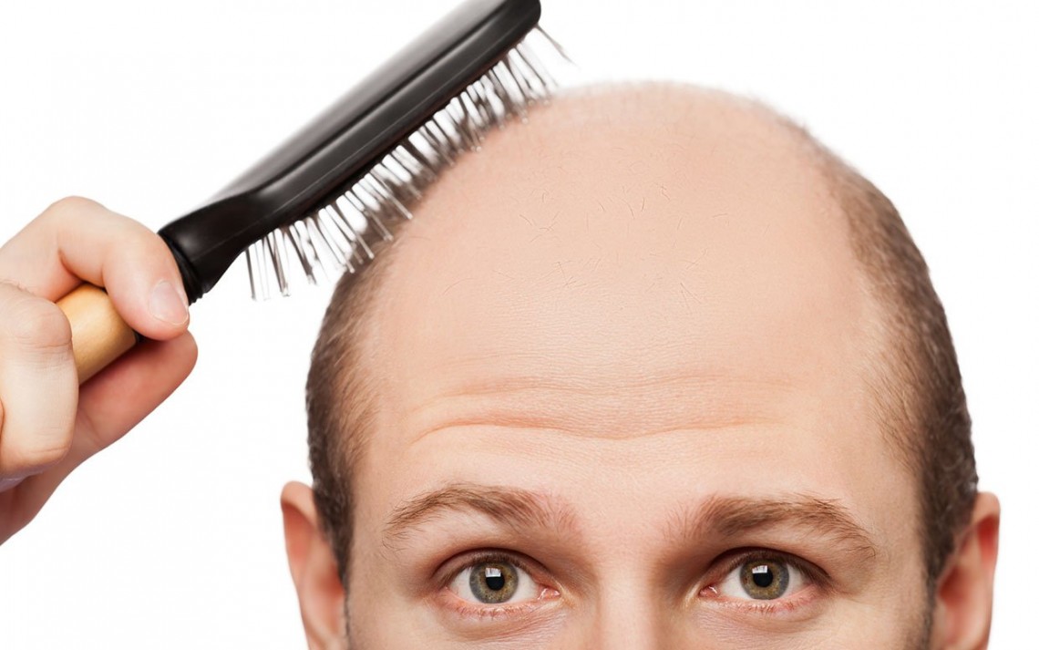 معلومات مهمة جداً.. 12 سبباً لتساقط الشعر