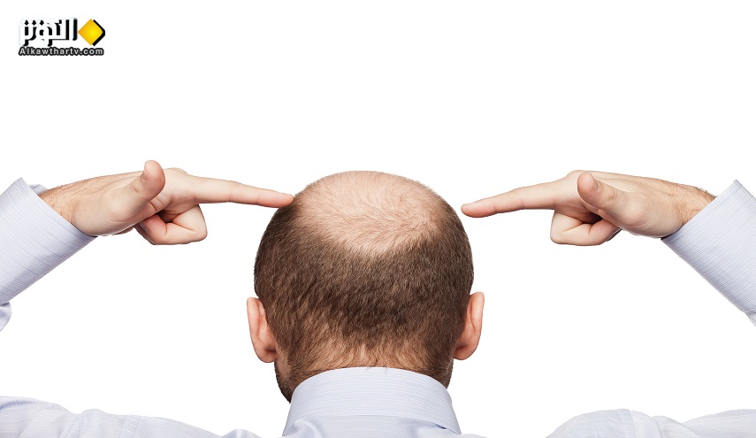 بشرى سارة : الكشف عن جذور ظاهرة تساقط شعر الرجال !
