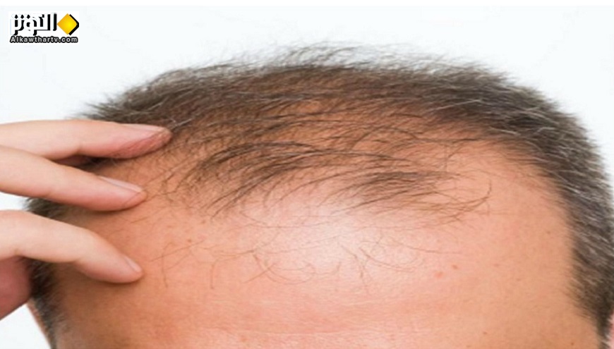 نصيحة ليحمي الخاضعون للعلاج الكيماوي شعر رأسهم