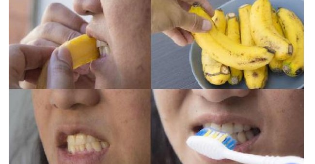 طريقة مضمونة لتبيض أسنانك باستخدام قشر الموز!