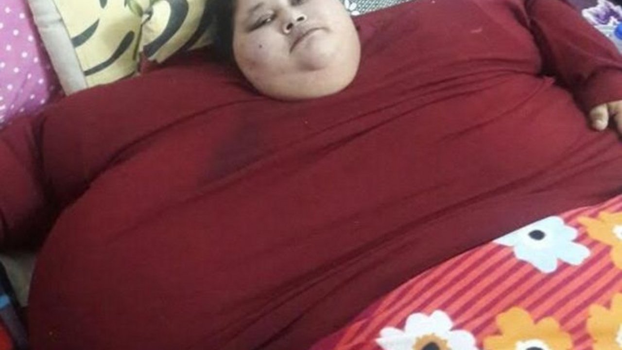صورة| شاهدوا كيف أصبحت المصرية صاحبة النصف طن بعد العلاج!