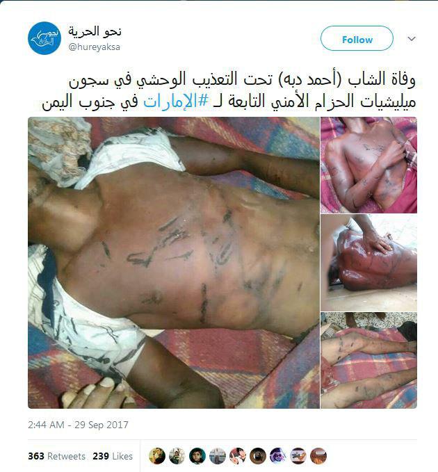 بالصور... وفاة يمني نتيجة تعذيب وحشي في سجن اماراتي باليمن