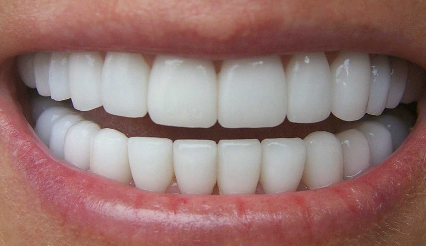 غسيل الاسنان يسبب تسوس الاسنان... اليكم التفاصيل!