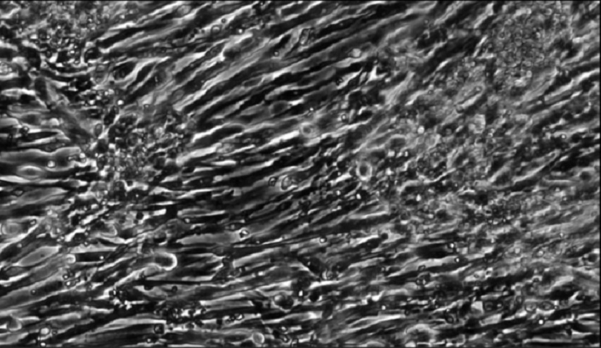 زراعة عضلات من خلايا جلدية لأول مرة في العالم