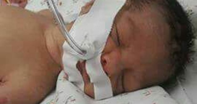 جان سپردن مظلومانه  نوزاد فلسطینی در غزه 