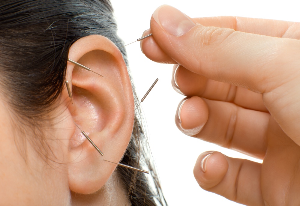 آيا طب سوزني براي درمان وزوز گوش موثر است؟