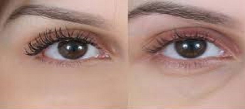 تعرف على عوامل ظهور الهالات السوداء حول العينين