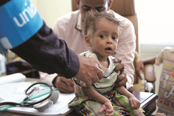 بهداشت جهانی: دیفتری در بیست استان یمن شیوع یافته است