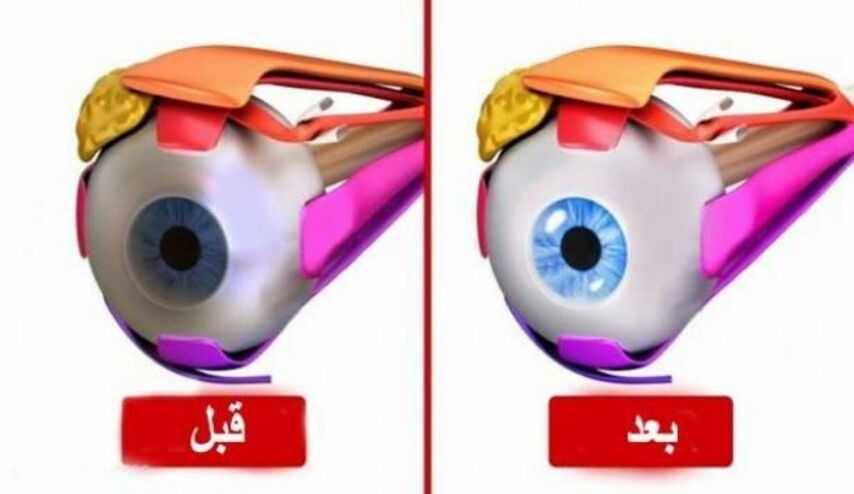 10 تمارين سهلة تقوي النظر .. جربها فلن تصدق مدى فائدتها