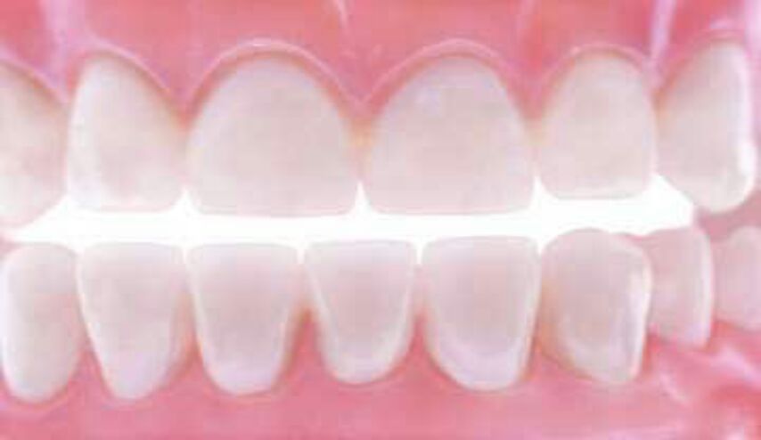 كيف تحصل على اسنان ناصعة البياض من دون اللجوء الى الطبيب؟