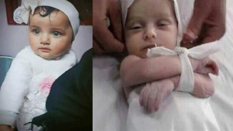 تصویر کودک هشت ماهه ای که توسط صهیونیستها به شهادت رسید !