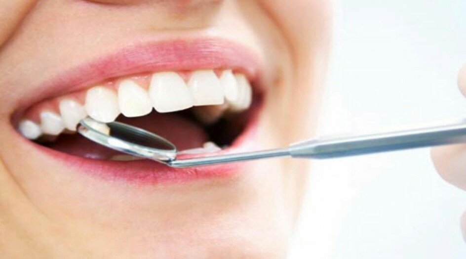 ما أهم المشروبات التي تسبّب إصفرار الأسنان؟ اليكم التفاصيل..