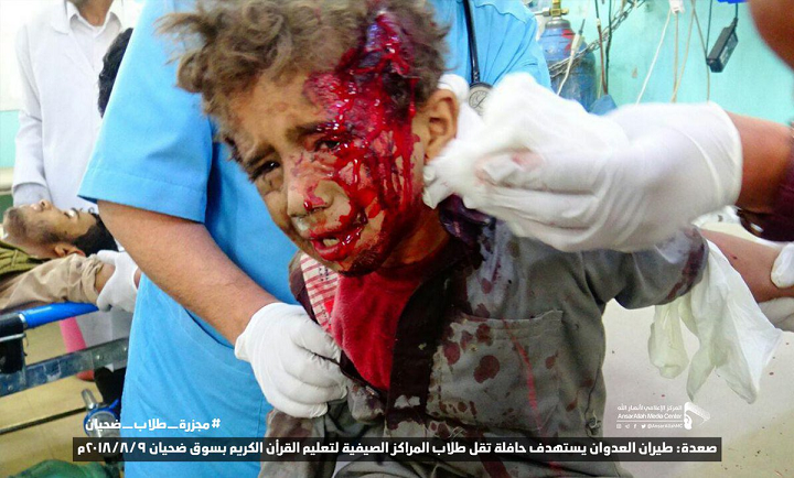 شهادت و زخمی شدن دهها زن و کودک یمنی در حمله ائتلاف سعودی به «الدریهمی»
