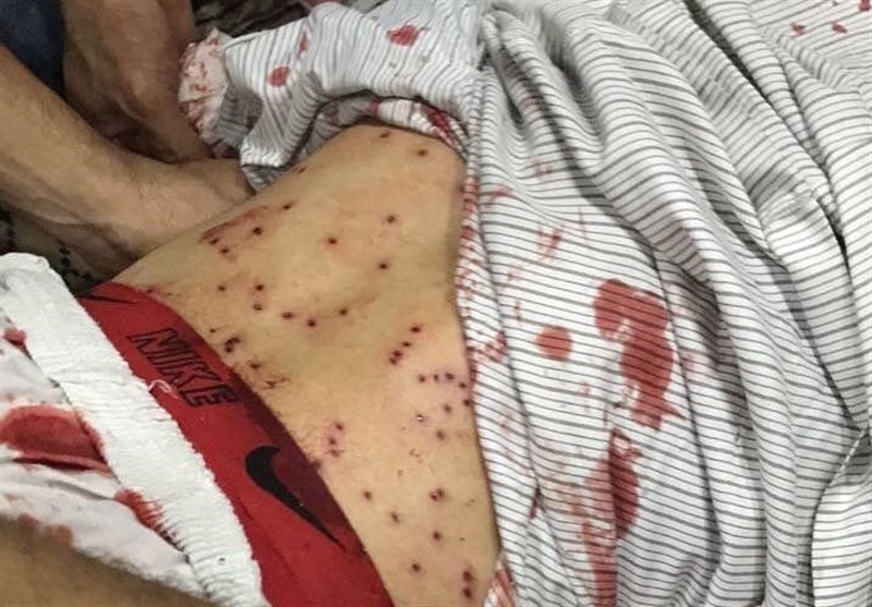 نقض حقوق بشر در بحرین؛ شیوع بیمارهای پوستی در زندان مرکزی "جو