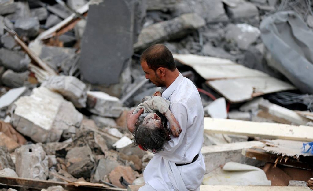 نیویورک تایمز:بمب های آمریکایی بر سر کودکان یمنی شرم آور است