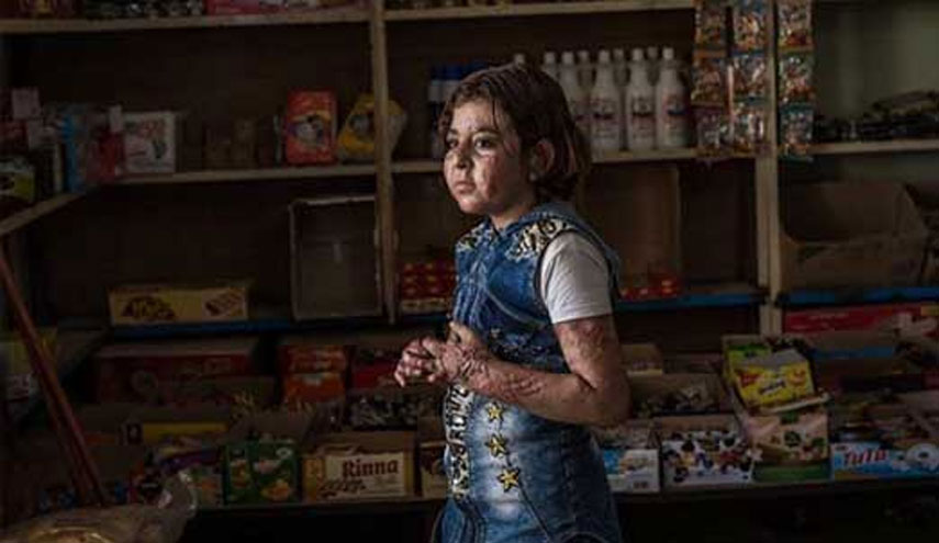 الناشطون يتعاطفون مع القصة المؤلمة والمؤثرة للطفلة العراقية "نور"..