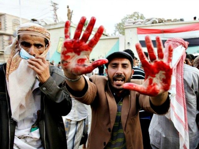 مردودی مدعیان حقوق بشر در آزمون یمن