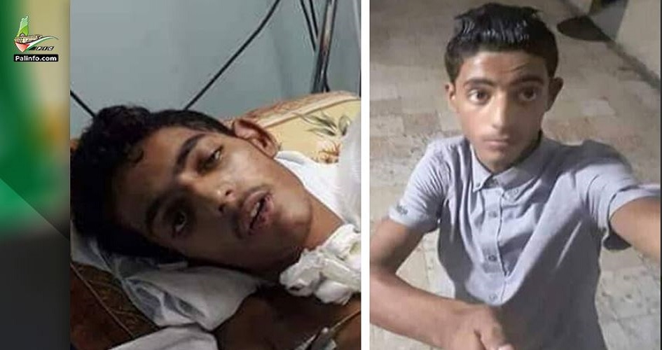 استشهاد طفل متأثرًا بإصابته برصاص الاحتلال شرق خانيونس