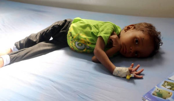 الجوع يهدد مليون طفل إضافي في اليمن