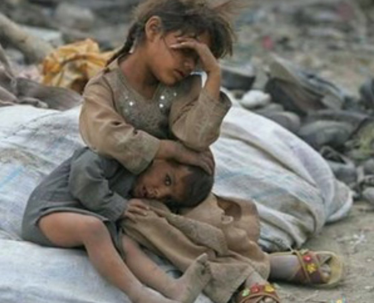 پنج میلیون کودک یمنی با قحطی و مرگ روبرو هستند