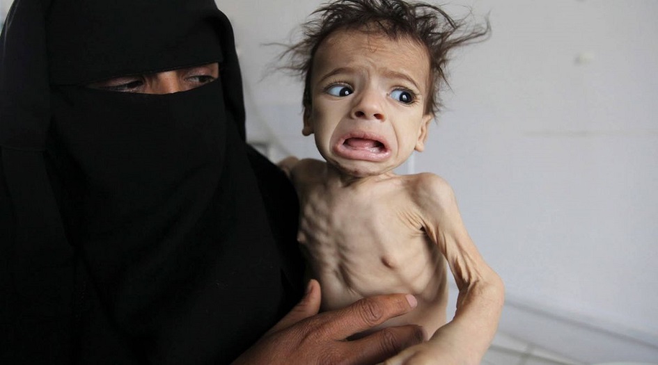 الأمم المتحدة: نصف اليمنيين على شفا المجاعة