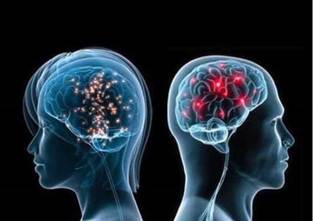 تفاوت مغز مردان با زنان در چیست؟