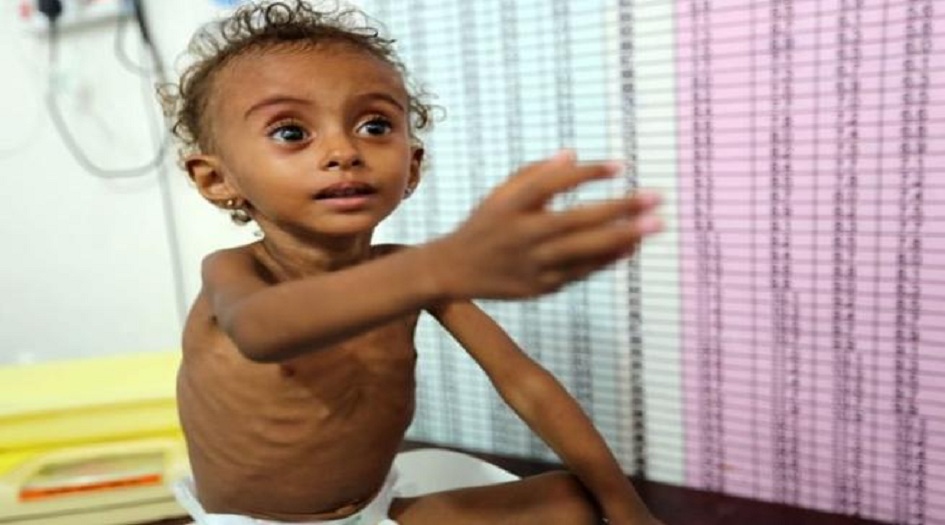 منظمة دولية: وفاة 85 ألف طفل يمني بسبب سوء التغذية